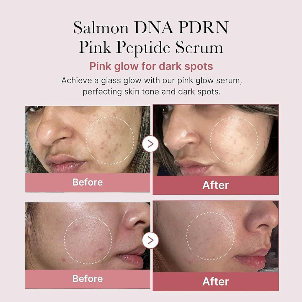 Medicube Pink Peptide Repair Serum